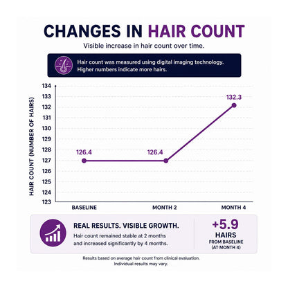 FOLIGAIN® Triple Action Conditioner For Thinning Hair For Women with 2% TRIOXIDIL® 473ml
