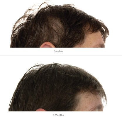 FOLIGAIN® Triple Action Shampoo For Thinning Hair For Women with 2% TRIOXIDIL®