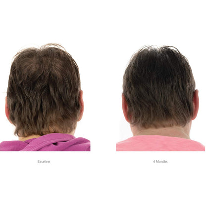 FOLIGAIN® Triple Action Conditioner For Thinning Hair For Women with 2% TRIOXIDIL® 473ml